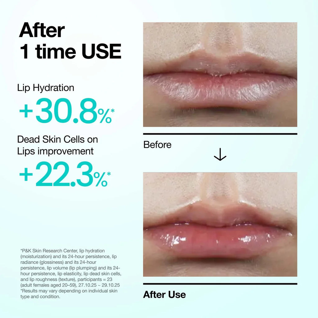 PDRN Lip Serum, 10ml